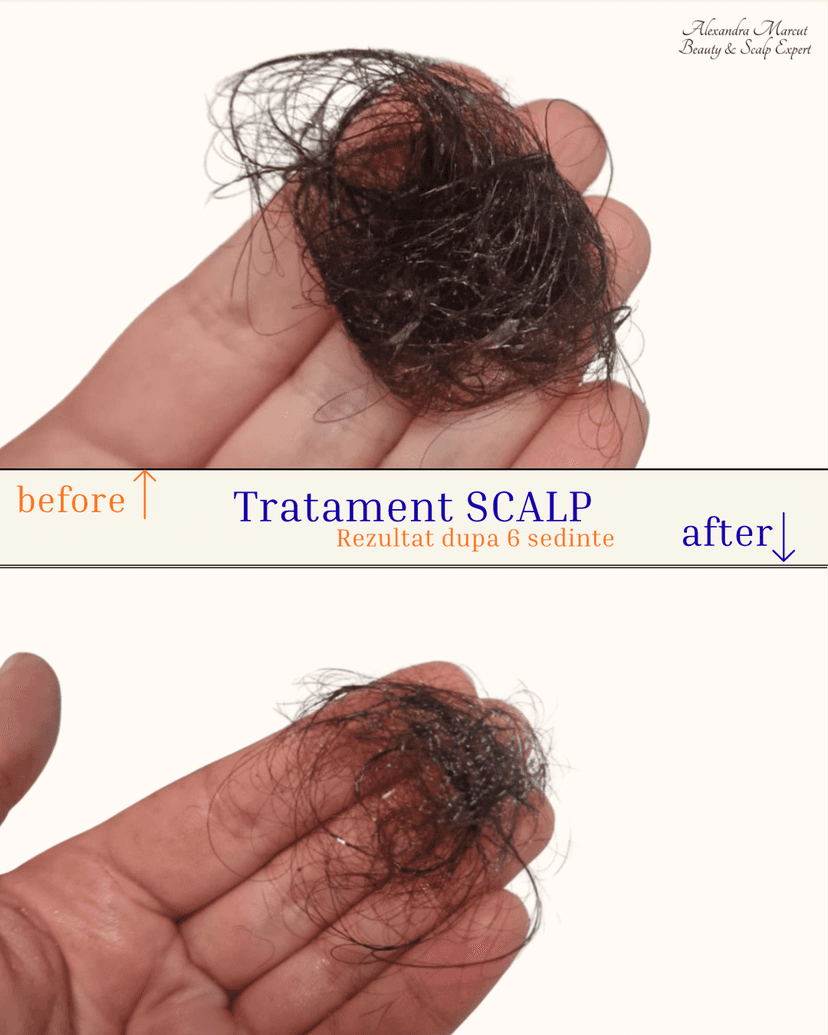 tratament_scalp.png